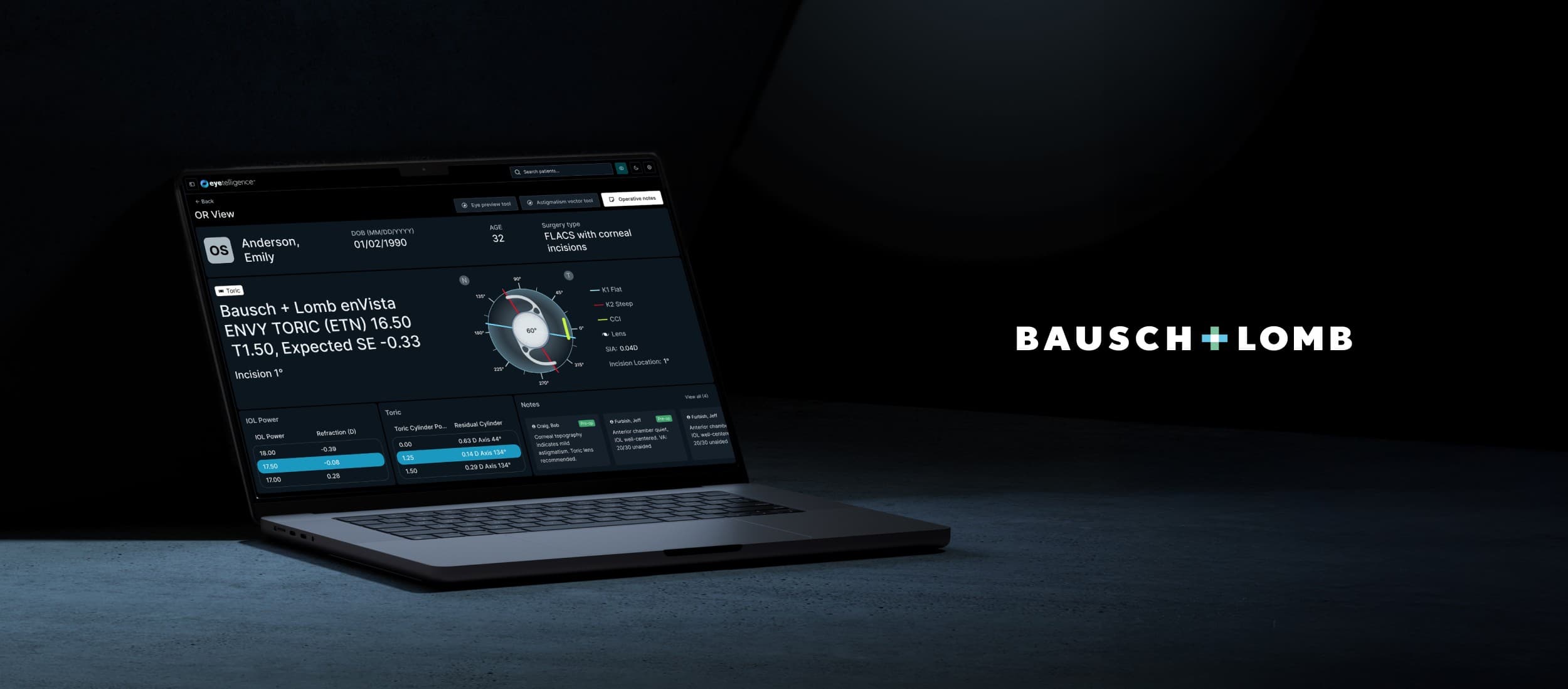 Eyetelligence by Bausch + Lomb